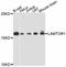 Ragulator complex protein PDRO antibody, abx126079, Abbexa, Western Blot image 