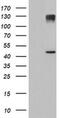 1-Acylglycerol-3-Phosphate O-Acyltransferase 5 antibody, MA5-25829, Invitrogen Antibodies, Western Blot image 