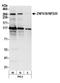 Zinc Finger Protein 638 antibody, A301-547A, Bethyl Labs, Western Blot image 