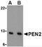 Presenilin Enhancer, Gamma-Secretase Subunit antibody, 3981, ProSci, Western Blot image 