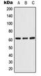 UDP Glycosyltransferase 8 antibody, GTX55898, GeneTex, Western Blot image 