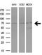 Protein Arginine Methyltransferase 5 antibody, TA807463, Origene, Western Blot image 