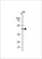 Retinol Dehydrogenase 10 antibody, LS-C162521, Lifespan Biosciences, Western Blot image 