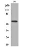 Cytochrome P450 Family 8 Subfamily B Member 1 antibody, orb160679, Biorbyt, Western Blot image 