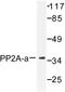 Protein Phosphatase 2 Catalytic Subunit Alpha antibody, AP06572PU-N, Origene, Western Blot image 