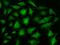 Fms Related Tyrosine Kinase 1 antibody, 10136-T18, Sino Biological, Immunohistochemistry frozen image 