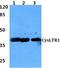 Cysteinyl Leukotriene Receptor 1 antibody, AP01264PU-N, Origene, Western Blot image 