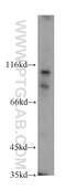 Dual serine/threonine and tyrosine protein kinase antibody, 20102-1-AP, Proteintech Group, Western Blot image 