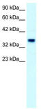 Forkhead Box F1 antibody, TA330236, Origene, Western Blot image 