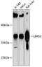 LIM Zinc Finger Domain Containing 2 antibody, 14-859, ProSci, Western Blot image 