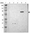 SHC-transforming protein 2 antibody, NBP1-87076, Novus Biologicals, Western Blot image 