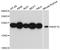 NOP16 Nucleolar Protein antibody, A12598, Boster Biological Technology, Western Blot image 