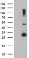 Regulatory Factor X Associated Ankyrin Containing Protein antibody, TA504273S, Origene, Western Blot image 