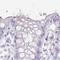 Glutathione S-Transferase Alpha 1 antibody, HPA053817, Atlas Antibodies, Immunohistochemistry frozen image 