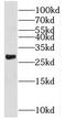 Ras Homolog Family Member T2 antibody, FNab07287, FineTest, Western Blot image 