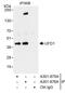 Ubiquitin Recognition Factor In ER Associated Degradation 1 antibody, A301-876A, Bethyl Labs, Immunoprecipitation image 
