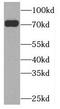 PRK antibody, FNab06549, FineTest, Western Blot image 