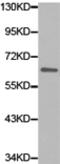 High molecular weight kininogen antibody, TA321224, Origene, Western Blot image 
