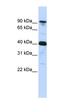 Cysteinyl-TRNA Synthetase antibody, orb330104, Biorbyt, Western Blot image 