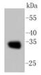 Calponin 1 antibody, NBP2-67401, Novus Biologicals, Western Blot image 
