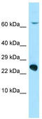 Vitamin K Epoxide Reductase Complex Subunit 1 Like 1 antibody, TA333457, Origene, Western Blot image 