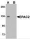 Rap Guanine Nucleotide Exchange Factor 4 antibody, NBP2-82089, Novus Biologicals, Western Blot image 