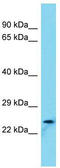 Refilin B antibody, TA331542, Origene, Western Blot image 