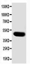 S-phase kinase-associated protein 2 antibody, PA1102, Boster Biological Technology, Western Blot image 