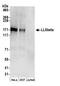 Pleckstrin Homology Like Domain Family B Member 2 antibody, A304-582A, Bethyl Labs, Western Blot image 