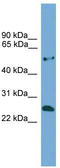 ETHE1 Persulfide Dioxygenase antibody, TA334508, Origene, Western Blot image 