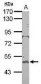 BTB/POZ domain-containing protein 10 antibody, PA5-28889, Invitrogen Antibodies, Western Blot image 