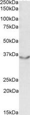Junctional Adhesion Molecule 2 antibody, GTX88378, GeneTex, Western Blot image 
