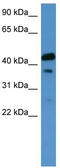 Calcitonin Receptor antibody, TA342679, Origene, Western Blot image 
