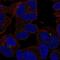 Solute Carrier Family 35 Member D3 antibody, NBP2-57003, Novus Biologicals, Immunocytochemistry image 