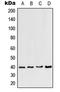 C-C Motif Chemokine Receptor Like 2 antibody, LS-C353121, Lifespan Biosciences, Western Blot image 