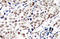 Checkpoint Kinase 1 antibody, AP20929PU-N, Origene, Immunohistochemistry frozen image 