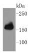 APC Regulator Of WNT Signaling Pathway antibody, NBP2-67625, Novus Biologicals, Western Blot image 