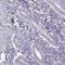 Glutamate Ionotropic Receptor Delta Type Subunit 2 antibody, PA5-63583, Invitrogen Antibodies, Immunohistochemistry frozen image 