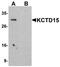 Potassium Channel Tetramerization Domain Containing 15 antibody, NBP1-77007, Novus Biologicals, Western Blot image 