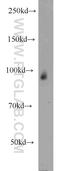Chromodomain Helicase DNA Binding Protein 2 antibody, 12311-1-AP, Proteintech Group, Western Blot image 
