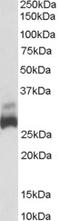 Succinate Dehydrogenase Complex Iron Sulfur Subunit B antibody, STJ70749, St John
