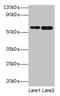 SCP 2 antibody, CSB-PA020856DA01HU, Cusabio, Western Blot image 