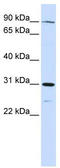 LON Peptidase N-Terminal Domain And Ring Finger 3 antibody, TA330468, Origene, Western Blot image 
