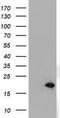 ADP Ribosylation Factor Like GTPase 2 Binding Protein antibody, TA800365, Origene, Western Blot image 