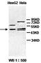 Proteasome 26S Subunit, ATPase 3 antibody, orb77375, Biorbyt, Western Blot image 