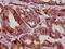 Mitochondrially Encoded Cytochrome C Oxidase II antibody, CSB-PA015073LA01HU, Cusabio, Immunohistochemistry paraffin image 