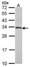 TIMP Metallopeptidase Inhibitor 4 antibody, GTX114942, GeneTex, Western Blot image 