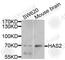 Hyaluronan synthase 2 antibody, A9897, ABclonal Technology, Western Blot image 