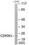 Cyclin Dependent Kinase Inhibitor 3 antibody, EKC1837, Boster Biological Technology, Western Blot image 