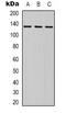 ERBB2 antibody, orb338985, Biorbyt, Western Blot image 